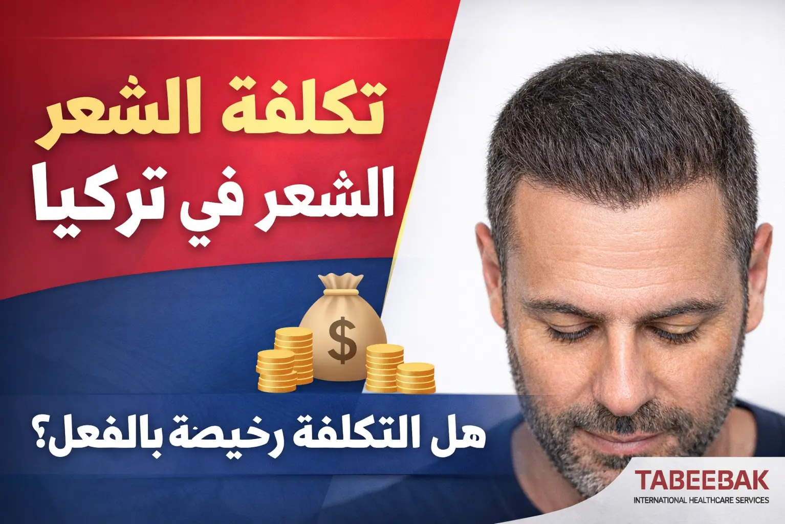 تكلفة زراعة الشعر في تركيا