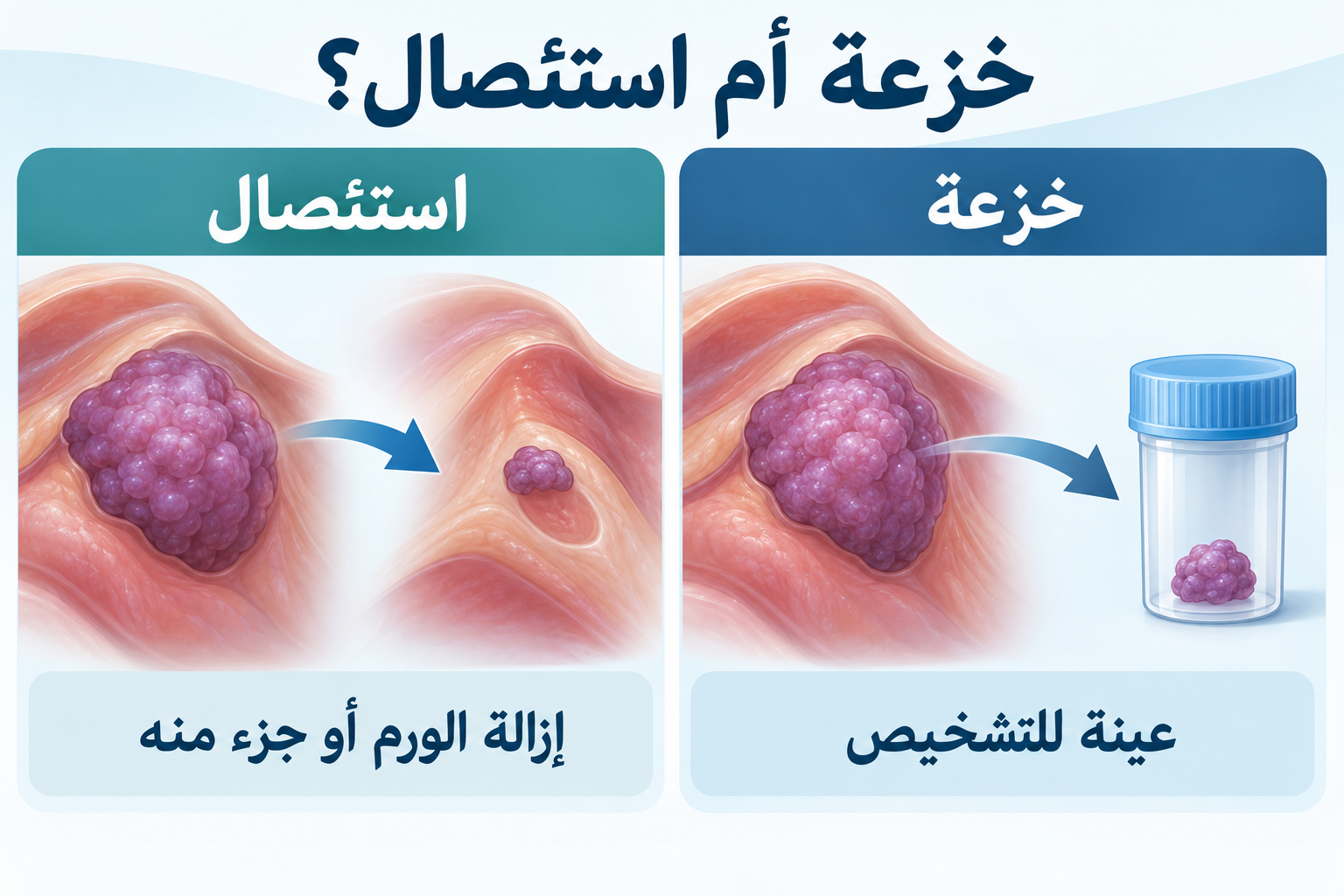 الفرق بين خزعة ورم الدماغ واستئصال الورم جراحيا