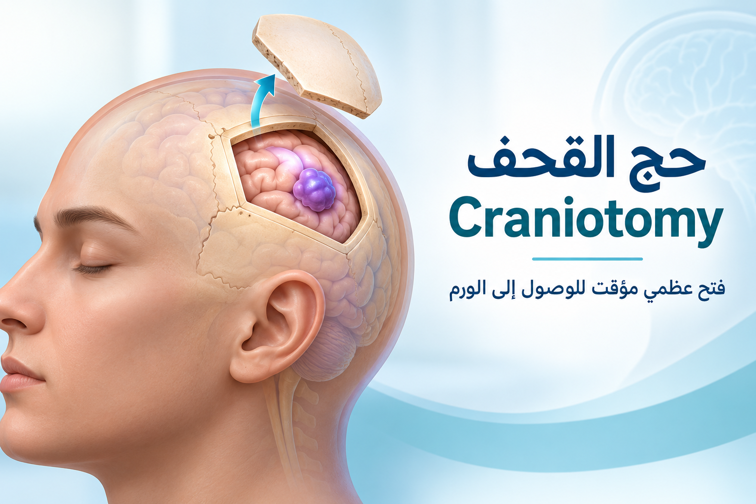 حج القحف واستئصال ورم الدماغ Craniotomy