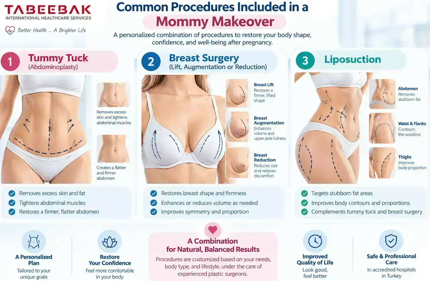 Common procedures included in a mommy makeover